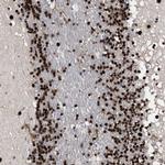 53BP1 Antibody in Immunohistochemistry (Paraffin) (IHC (P))