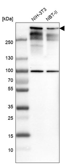 53BP1 Antibody in Western Blot (WB)
