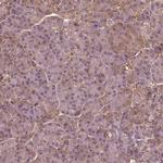 SAT2 Antibody in Immunohistochemistry (IHC)