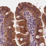 SAT2 Antibody in Immunohistochemistry (IHC)