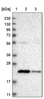 SAT2 Antibody in Western Blot (WB)