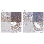 PFAS Polyclonal Antibody