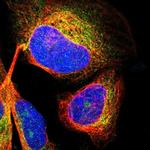 CDK5RAP3 Polyclonal Antibody