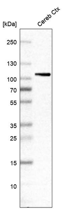 ATP6V0A1 Antibody in Western Blot (WB)