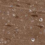 GARNL4 Polyclonal Antibody