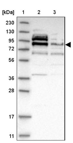 Axotrophin Antibody in Western Blot (WB)