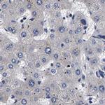 Axotrophin Antibody in Immunohistochemistry (IHC)