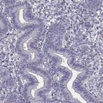SPACA9 Antibody in Immunohistochemistry (IHC)