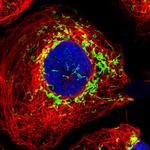 SPACA9 Polyclonal Antibody