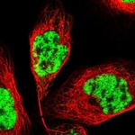 PRPF4 Polyclonal Antibody