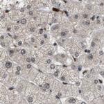 PRPF4 Antibody in Immunohistochemistry (IHC)