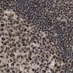 PRPF4 Antibody in Immunohistochemistry (IHC)