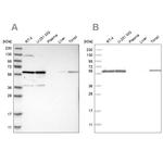 PRPF4 Antibody in Western Blot (WB)