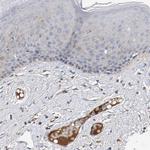 MAMDC2 Antibody in Immunohistochemistry (IHC)