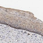 MAMDC2 Antibody in Immunohistochemistry (IHC)