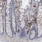 MAMDC2 Antibody in Immunohistochemistry (IHC)