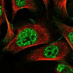 MAMDC2 Antibody in Immunocytochemistry (ICC/IF)
