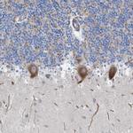 NYAP1 Antibody in Immunohistochemistry (IHC)