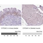CYP24A1 Antibody in Immunohistochemistry (IHC)