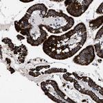 ACADS Antibody in Immunohistochemistry (IHC)