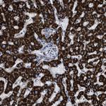 ACADS Antibody in Immunohistochemistry (IHC)