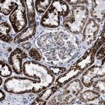 ACADS Antibody in Immunohistochemistry (IHC)