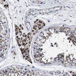 ACADS Antibody in Immunohistochemistry (IHC)