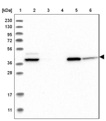 ACADS Antibody in Western Blot (WB)