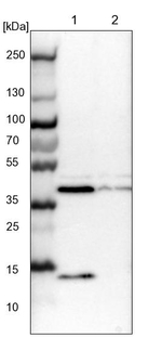 ACADS Antibody in Western Blot (WB)