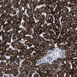 ACADS Antibody in Immunohistochemistry (IHC)