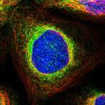 PPM1D Polyclonal Antibody