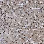 PPM1D Antibody in Immunohistochemistry (IHC)
