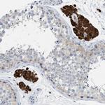 PPM1D Antibody in Immunohistochemistry (IHC)