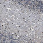 PPM1D Antibody in Immunohistochemistry (IHC)