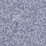 PPM1D Antibody in Immunohistochemistry (IHC)