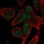 AEBP2 Antibody in Immunocytochemistry (ICC/IF)