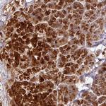 AEBP2 Antibody in Immunohistochemistry (Paraffin) (IHC (P))