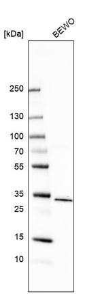 AEBP2 Antibody in Western Blot (WB)