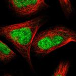 ZNF462 Polyclonal Antibody