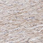 ZNF462 Antibody in Immunohistochemistry (IHC)