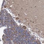 TWISTNB Antibody in Immunohistochemistry (IHC)