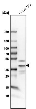 TWISTNB Antibody in Western Blot (WB)