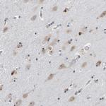 POLR1E Antibody in Immunohistochemistry (Paraffin) (IHC (P))