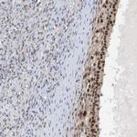 POLR1E Antibody in Immunohistochemistry (Paraffin) (IHC (P))
