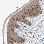 POLR1E Antibody in Immunohistochemistry (Paraffin) (IHC (P))