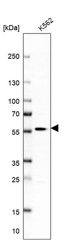 POLR1E Antibody in Western Blot (WB)