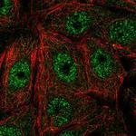 FAM117A Polyclonal Antibody