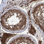 FAM117A Antibody in Immunohistochemistry (Paraffin) (IHC (P))