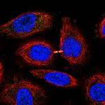 SLN13 Antibody in Immunocytochemistry (ICC/IF)