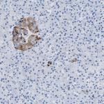 SLN13 Antibody in Immunohistochemistry (Paraffin) (IHC (P))